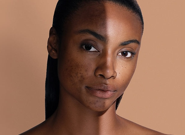 Peeling | Medestetics - Skincare Solutions